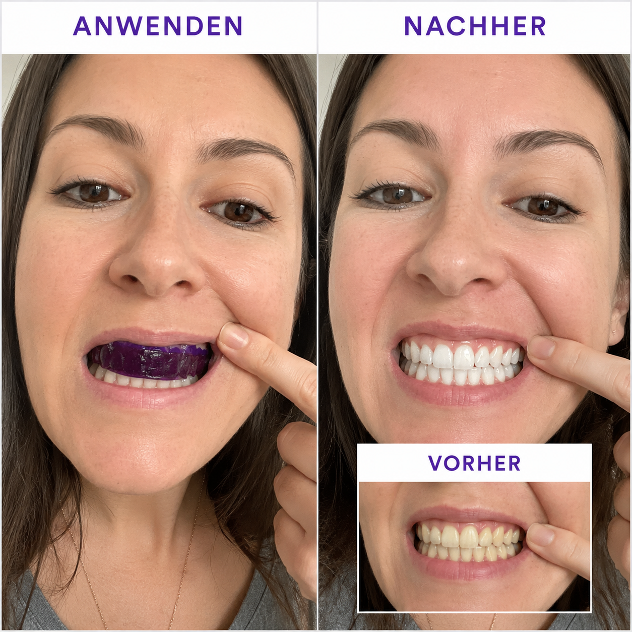 MySmilo V34 Whitening Strips – mit der Doppel-Weiß Formel